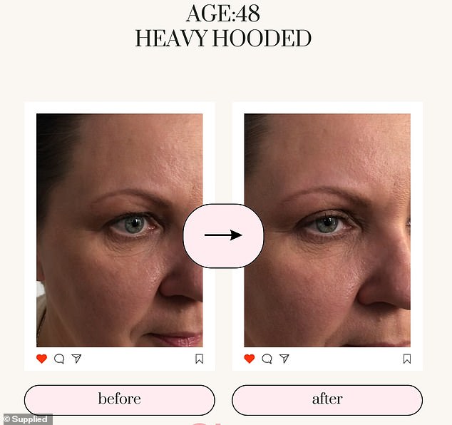 The innovative eyelid product combines the benefits of eyelid tape and eyelid glue.
