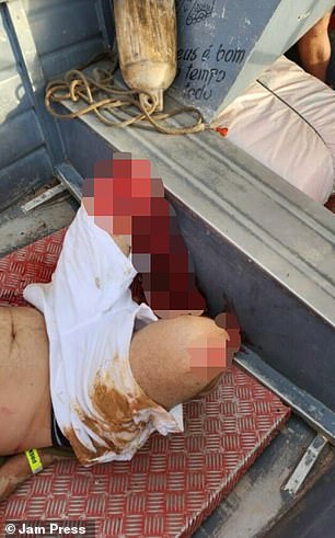 Images taken of the man in a small boat show how his left leg was covered in blood.