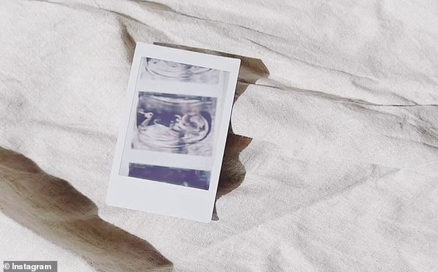 The couple shared a scan of their son on Instagram and said they were excited to meet their 'rainbow baby'.