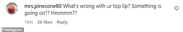 One fan said: 'What's wrong with your upper lip? Something is happening?? Mmmmm??' while another Twitter user asked: 'What the hell is that lump in the middle of his upper lip?'