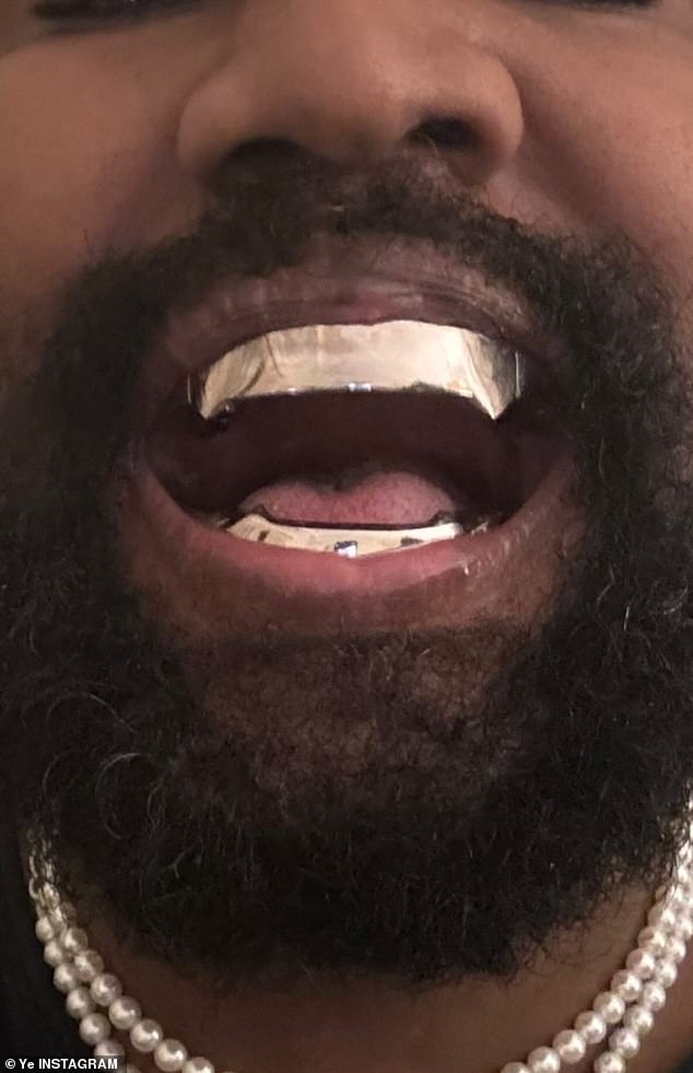 Just a few weeks ago, Kanye showed off his new metallic smile in an Instagram post, in which he compared his appearance to that of iconic James Bond villain Jaws. However, sources close to the star say the 46-year-old hasn't actually 