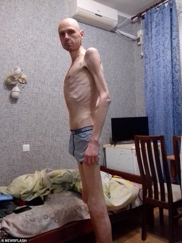 Volodymyr, who is 6.2 feet tall, has lost almost half his body weight and now weighs just 57kg.  His skeletal body is so thin you can count every rib, and his painfully gaunt arms hang like pipe cleaners.