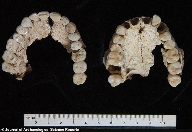 Teeth from Tomb I: The one on the left is a 