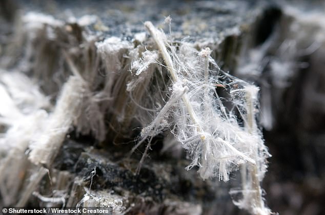 Mesothelioma is a type of cancer that develops in the lining that covers the surface of some organs in the body, primarily the lining of the lungs. It is usually related to exposure to asbestos. In the image, chrysotile asbestos fibers.