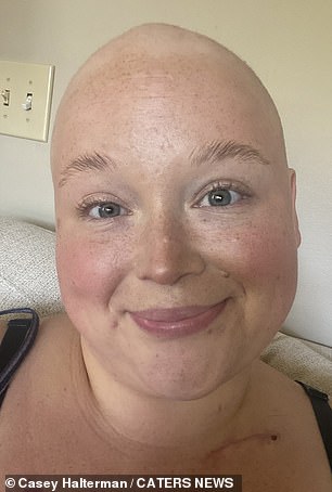 Because her cancer was so intense, doctors quickly recommended that Casey undergo a complete hysterectomy to reduce the chances of it returning.