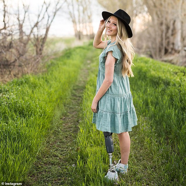 The Idaho teen ultimately lost her leg in the accident, but says landing on the power line saved her life, as the electricity cauterized a torn artery and stopped her from bleeding.