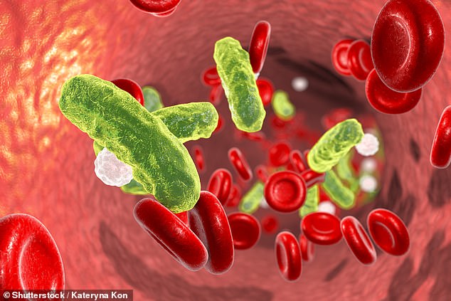 Bacterial infections are one of the most common causes of sepsis. Blood tests may look for an increase in white blood cells, which indicates the presence of an infection.