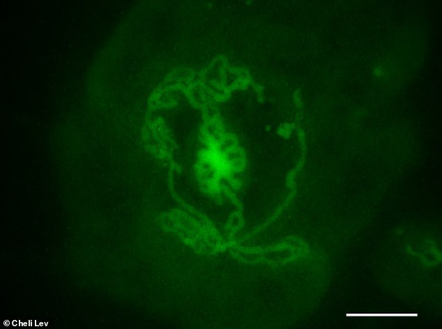 This testicular organoid was created from mouse embryos and incubated in a dish for 14 days. The tubular structures are the same. Marked in green are the Sertoli cells, which are the cells responsible for the formation of the tubules in the testicle and actually create the tubules in the plate.