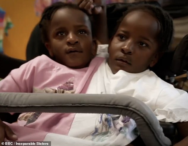 Marieme and Ndeye (pictured recently) were born in Senegal in 2016, where doctors believed their best chance for survival was separation.  The family contacted hospitals around the world, including Belgium, Germany, Zimbabwe, Norway, Sweden and the United States, 