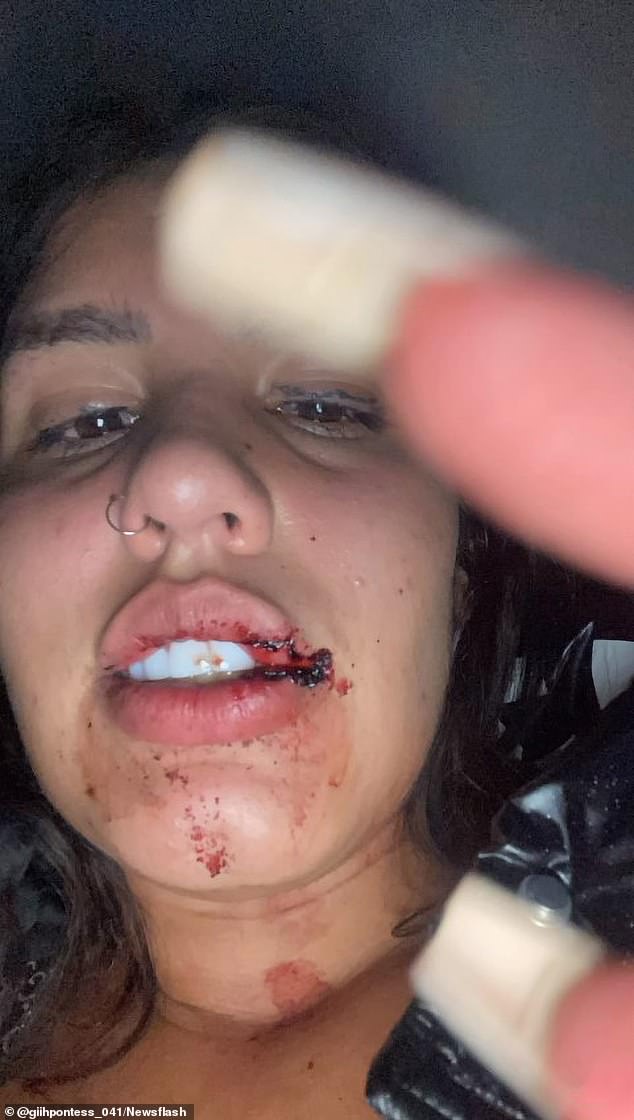Widely reported in Brazilian media, Pontes alleged that she was attacked by other influencers