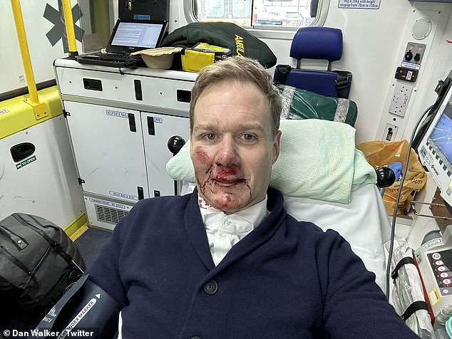 The accident left him battered and bruised with a bloody face, but fortunately, Dan was lucky to avoid serious injury.