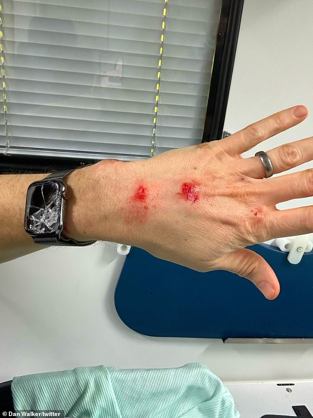 Painful: cuts on the TV presenter's hand after the terrifying accident