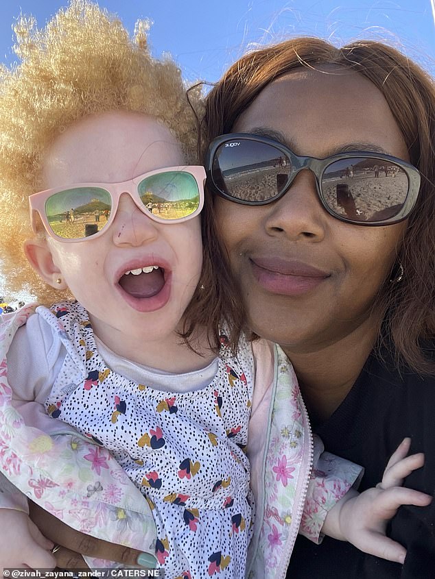 People with albinism often suffer from poor vision due to a reduced amount of melanin in the cell layer of the eye, as well as having an increased risk of sunburn and skin cancer. Zayana and her mother in the photo.