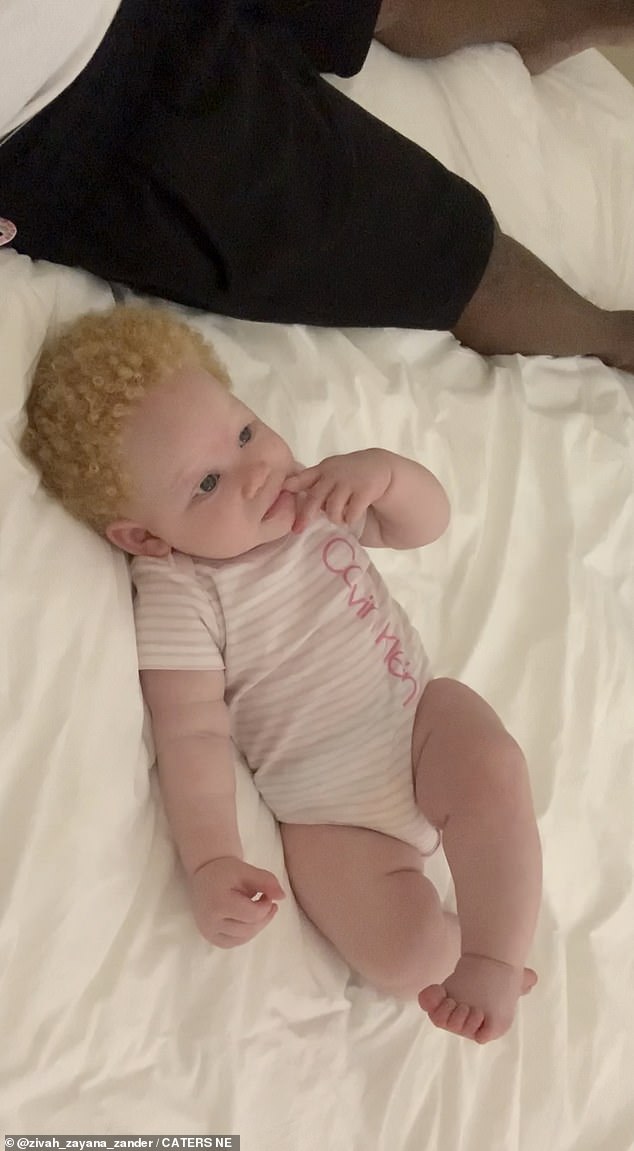 Belvana Abeli's two-year-old daughter Zayana Domingos was born with albinism