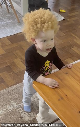 1709121254 966 Black South African woman whose daughter was born albinism reveals