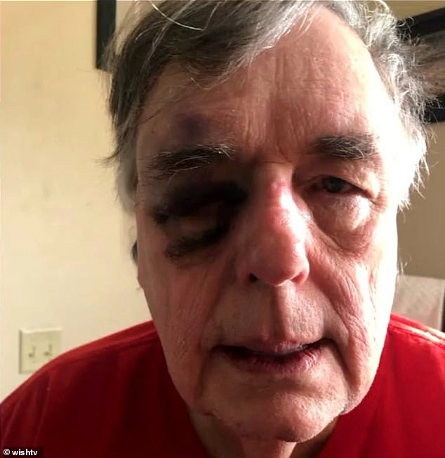 A 74-year-old substitute teacher was brutally beaten by a six-foot-two-inch, 280-pound student in Indiana earlier this month.