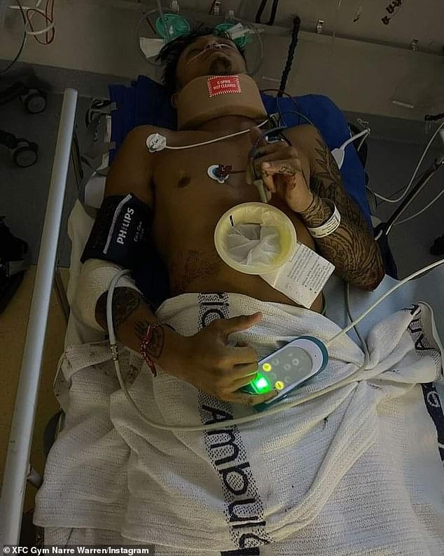 Harley Robinson, 25, was thrown from his bike in an alleged road rage incident. He appears in the photo recovering from the hospital.