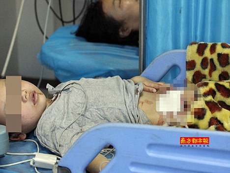 Despicable: a photo of the six-year-old boy whose father bit off his penis in Shenzhen, in the Chinese province of Guangdong