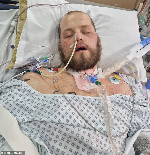 Doctors had little hope that Ben Wilson, 31, who suffered a massive heart attack at his home in June, would survive after paramedics were forced to shock him 17 times to restart his heart.