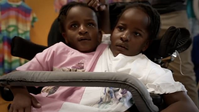 Marieme and Ndeye, joined at the pelvis, have serious and unavoidable medical needs - Inseparable Sisters (BBC1)