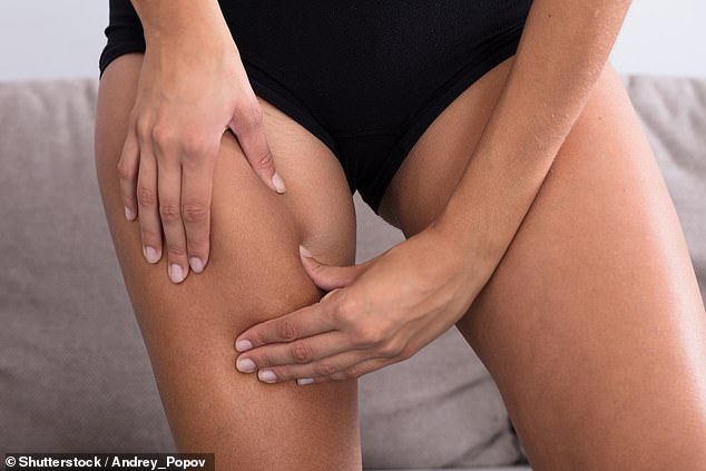 Inge Van Lotringen reveals what can be done about cellulite (file image)
