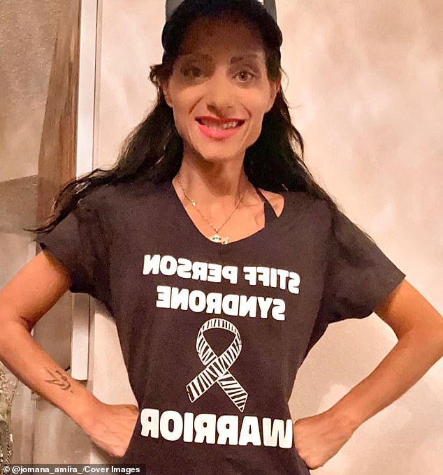 Mrs. Houssari is just one of 330 Americans with stiff person syndrome. When she was first diagnosed, her doctor had never encountered the condition.