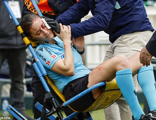 LaLiga assistant referee Guadalupe Porras was left bloodied after colliding with a camera