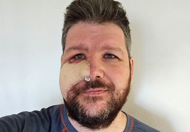 Pär Sundström, 42, suffered horrific injuries and had to undergo facial reconstruction after the beast slammed him to the ground and bit his cheek amid the attack in Ljusdal, central Sweden, last August.