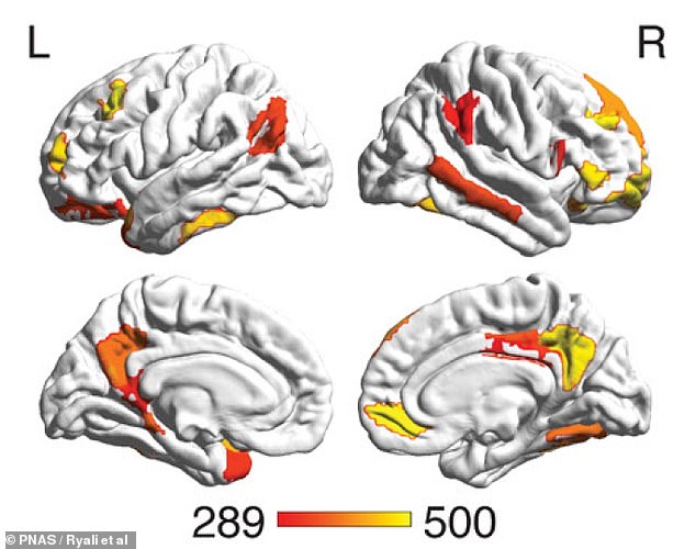 This image from the new study shows which parts of the brain are most important for distinguishing between men and women: the striatum and areas involved in the default mode network and the limbic network.