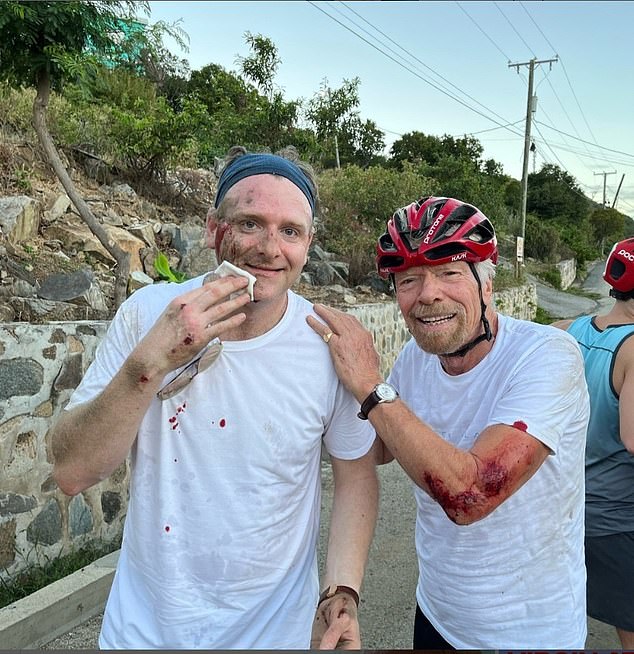 Richard Branson has shared an image of his injuries on Instagram after a cycling accident