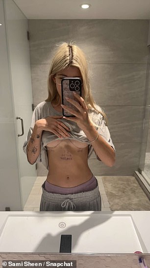 Zoomer's nepo-baby previously documented her boob job process before and after the Nov. 15 procedure.