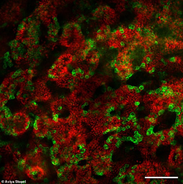 These testicular organoids were cultured from cells from mouse pups and incubated in a dish for 21 days. Sertoli cells (red) are responsible for the formation of tubules in the testicle. The germ cells (green) will produce sperm.