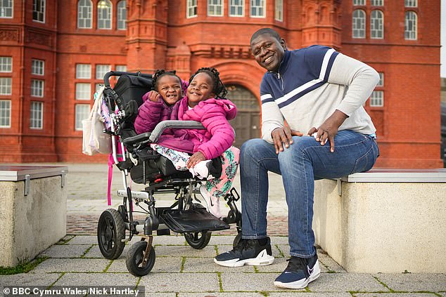 Senegalese father who lives in Cardiff with his conjoined twin
