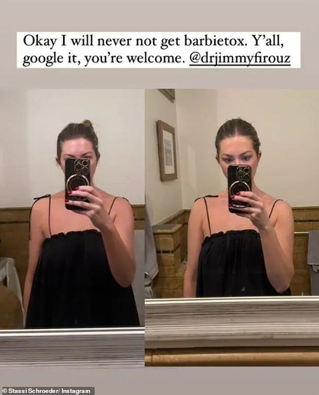 The 35-year-old reality TV personality posted before and after photos to her Instagram Stories on Thursday after undergoing the cosmetic procedure.