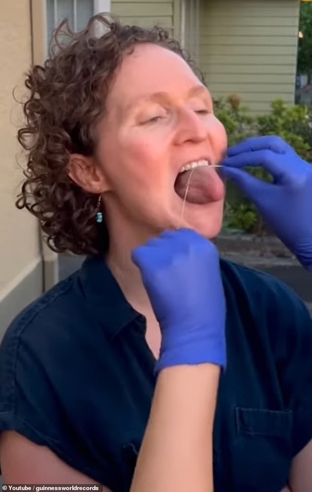 DuVander's dentist measured her tongue with dental floss.