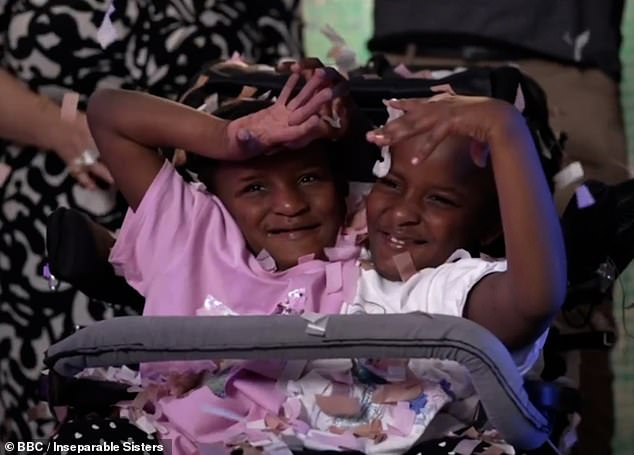 Conjoined twins Marieme and Ndeye (pictured) have separate brains, hearts and lungs, but share a liver, bladder, digestive system and three kidneys.  Because of their condition, dressing girls can be difficult, her father revealed.