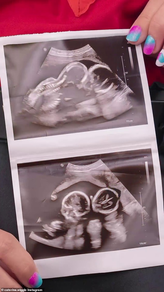 Caterina also shared her ultrasound showing her twins in the touching video as she shared her exciting news.