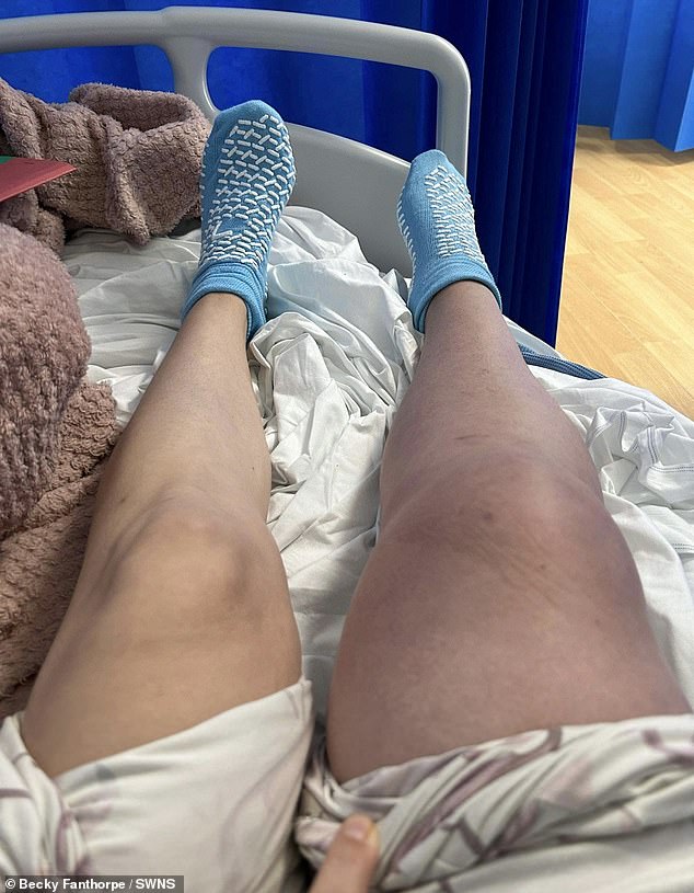 A Covid-19 attack left Becky with clogged blood clots in her leg