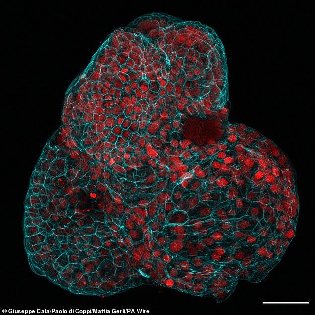 Stem cells were successfully extracted from the lungs, kidneys and intestine and used to grow organoids that had functional characteristics of these tissue types. In the photo: the mini lung