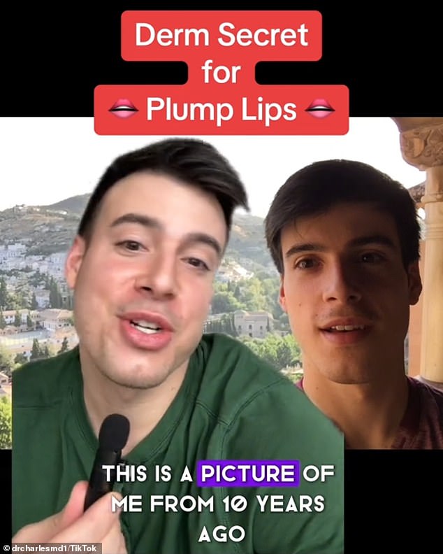 In a separate video, Dr. Charles shared the 'dermatology secret to full lips' and said people always ask him if he has lip fillers, even though he doesn't.