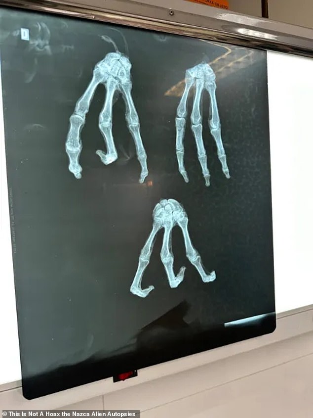 So far, the filmmaking couple reports that they have had X-rays (above), DNA and other laboratory tests performed on one of the apparently mummified bodies, filmed in collaboration with U.S. scientists on locations in Mexico and Peru.