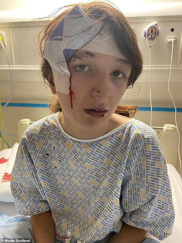 Abbie (pictured), then aged 12, was lured to a park in the city's Drumchapel, where a 13-year-old boy attacked her with multiple kicks to the head and left her covered in blood, while other teenagers filmed the stroke. Their phones