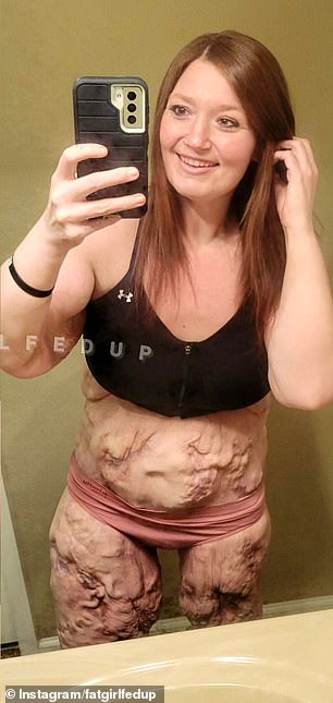 Weight loss influencer Lexi Reed (seen after) teased her figure after losing 100 pounds