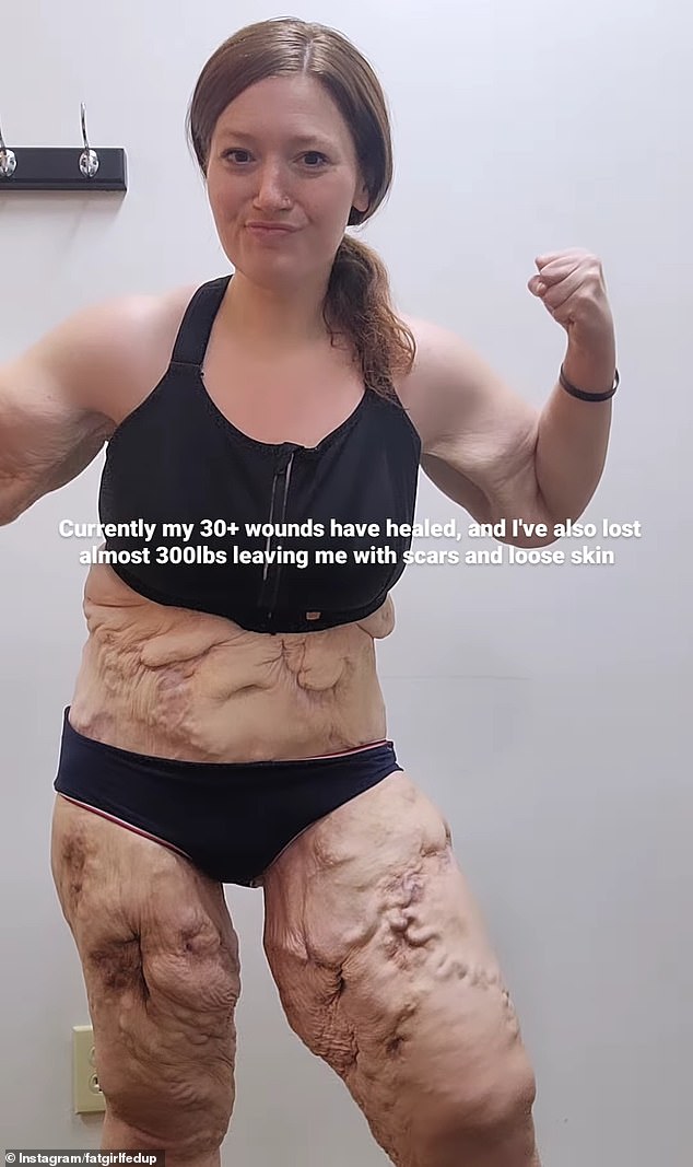 1709844747 595 Weight loss influencer Lexi Reed 33 who almost DIED after