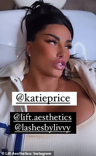 1709917703 810 Katie Price gets her THIRD round of lip fillers in