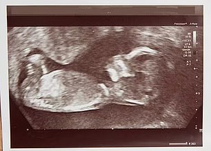 Ezra's baby scan