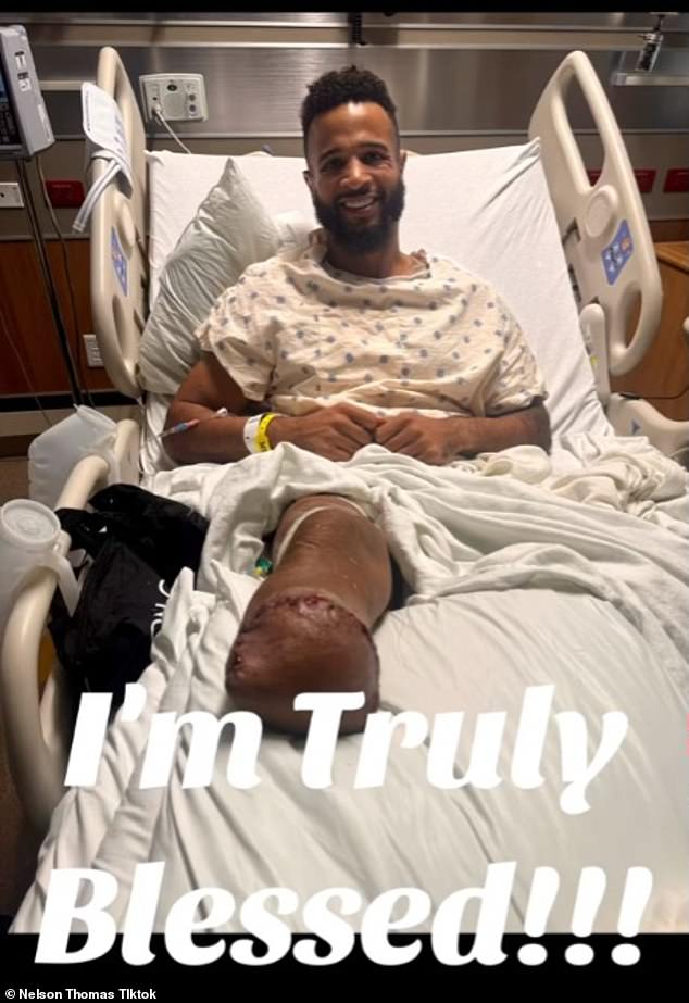 The Challenge star, who was charged with DWI seven months after the crash on March 5, 2023, uploaded a video to TikTok on Thursday shortly after the procedure.