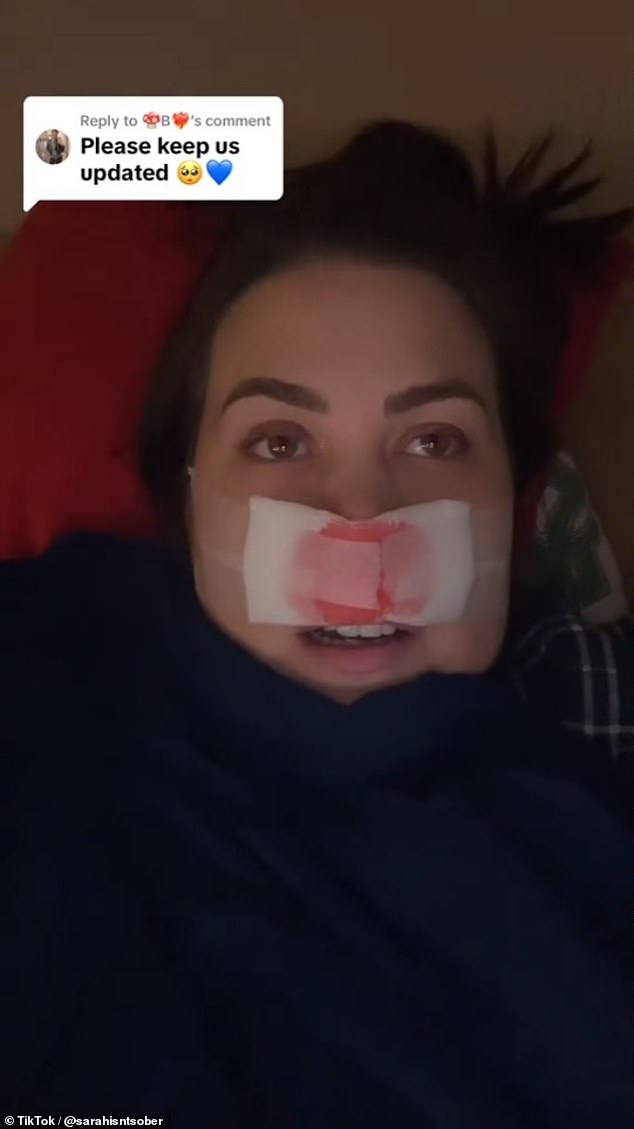 Speaking with a bandage from a recent rhinoplasty surgery still lining her face, the influencer revealed her less-than-legal dealings that took place about a decade ago