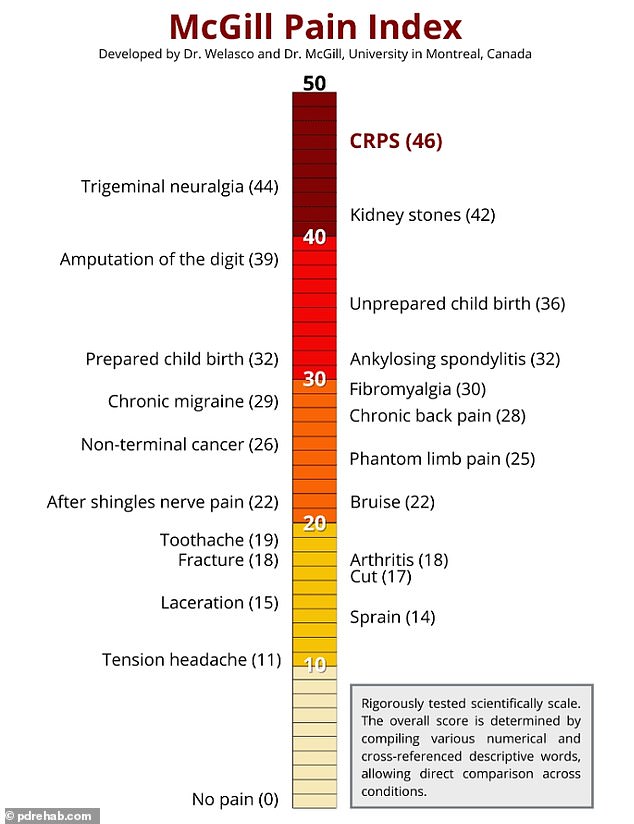 CRPS is a neurological disorder rated as the most painful condition on the McGill Pain Index (pictured), ranking higher than unmedicated childbirth