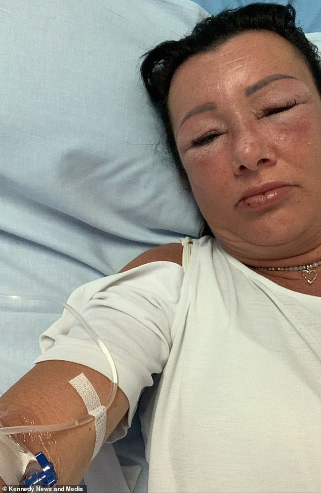 Mrs Egale woke up on the second day of her family holiday last April with a swollen face and struggling to breathe. The hospital staff acted quickly and treated her with a high dose of steroids and she was discharged later that day. But she said it took more than a week for her symptoms to subside